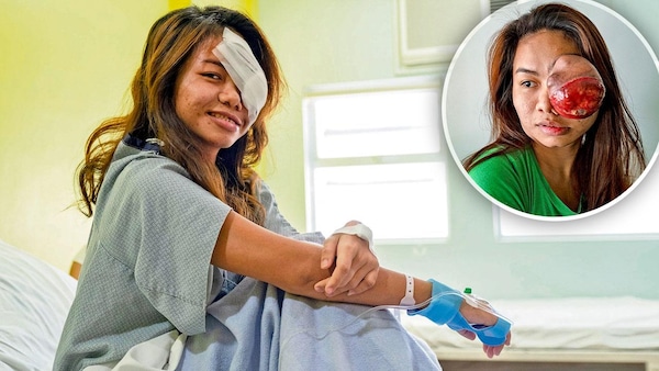 Ein Pflaster verdeckt die Stelle, an der der Tumor entfernt wurde: Sophia (18) in der Klinik in Manila, in der der Eingriff stattfand
Foto: Veejay Villafranca/Getty Images
