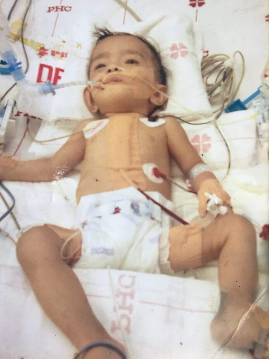 Margareth als Baby nach der Operation<br>Fotos: privat